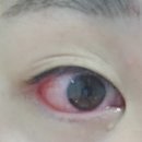 청주밝은안과의원 이미지