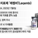 &#34;치매 종말의 시작&#34; 치매 늦추는 신약, 韓 들어온다…약값은? 이미지