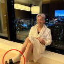 몽코지 이미지