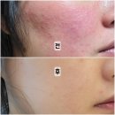 최피부과의원 이미지