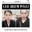 동작하이퍼 | 군산에스테틱 끝판왕 ‘나를새롭게만들다’ 후기｜군산피부샵·군산윤곽관리 단기간 효과 미쳤다