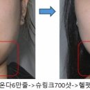 아이로피부과의원 이미지