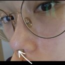 mc메디 | 내돈내산, 메디큐브 부스터프로 6개월차 사용법, 모드비교, 피부변화, 사용전후, 모공변화,얼빡샷있음