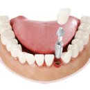 하나인치과병원 이미지