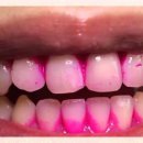 아름드리치과 이미지