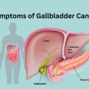 현대중앙병원 | 담낭암(Gallbladder cancer)에 대해서 / 암검진은 원주 현대중앙병원에서