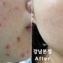 리유 이미지