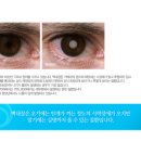 밝은희망안과의원 이미지