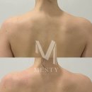 라인에너지 | [분당 바디관리 MESTY 후기] 에너지테라피로 승모근 &amp; 어깨라인 싹 정리!