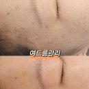 너반뷰티에스테틱 네이버블로그