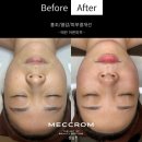 (주)보경팜 | 결혼준비 압구정 에스테틱 [매끄롬 청담점] 피부, 바디 관리 후기