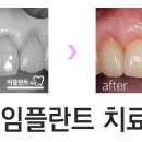 미플란트치과기공소 이미지