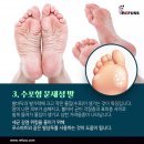 레푸스 화정점 네이버블로그