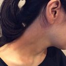 논산 습진 한의원 후기, 반복되던 가려움 잡기