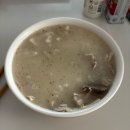 성대물혹,성대폴립 수술 후기(후두미세수술)