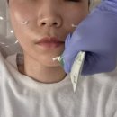 대전적산 | 용문동 피부관리 프리진뷰티에서 닥토필관리로 찐만족한 후기