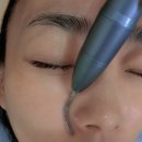 동산초교 | 삼송피부관리 맛집 속건조 잡는 LDM물방울 수분 방벽 케어 후기