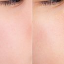 허브라인 이미지