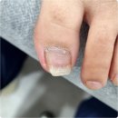 365 속시원한 가정의학과 의원 | 강서구 내성발톱 속이 후련해진 전문 관리