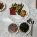 발견부터 수술까지.. 단계별 후기 공유 [2.수술(강남 르시엘 여성의원)] / 수술 준비물 / 단일공 복강경...