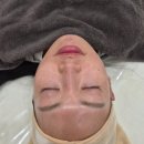 동산초교 | 고양피부관리 뷰티몬드 고양리프팅 잘하는 곳 추천 하이푸리프팅 후기