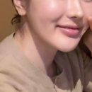 로데오로(1) | 압구정로데오피부과 티타늄리프팅 시술 효과, 통증 (내돈내산 솔직 후기)