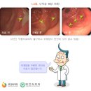 위