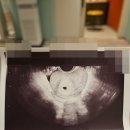 보건소 | 김포시 보건소 임산부 검사 후기｜임산부 등록부터 뱃지·엽산·지원금까지