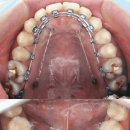 바닐라치과의원 이미지