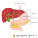 간내 담도암 임상적 추정으로 진단서 발급된 경우 담도암 진단비를 받을 수 있습니까? 이미지