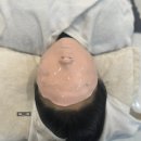 대호메디칼 | [에이원뷰티]산동피부관리 추천, 구미아쿠아필+피부LDM 솔직후기