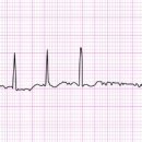 세동반점 | 아처 assess 첫번째