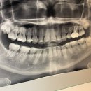 마로니에치과의원 이미지