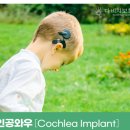 다비치 보청기 이미지