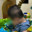 한림대성심병원 | 👶🏻[단두증 헬멧]한림대강남성심병원 이아리 교수님 진료 후기 🍼