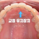 더고운치과기공소 네이버블로그