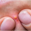 예한의원 이미지