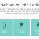 미소심는치과의원 네이버블로그