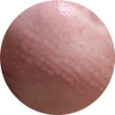 글로우의원 이미지