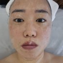 블랑드보떼 이미지