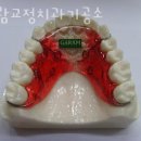 가람치과기공소 이미지