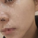 연희스킨케어 | [웨딩준비] 천안 청당동 문제성피부 전문 차올에스테틱 관리후기