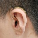 스타키보청기 이미지