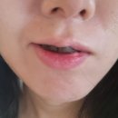 정인약국 | 붓기제거 고민된다면? 톡스핏 후기