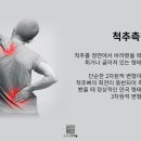 척추앤보상