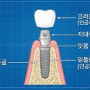 수정기공사 네이버블로그