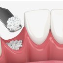 엔젤치과의원 이미지