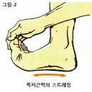 발바닥통증 // 족저근막염 이미지