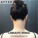 뒷목