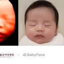 더블유여성병원 이미지